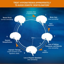 How is brain tissue different from other tissues during hyponatremia