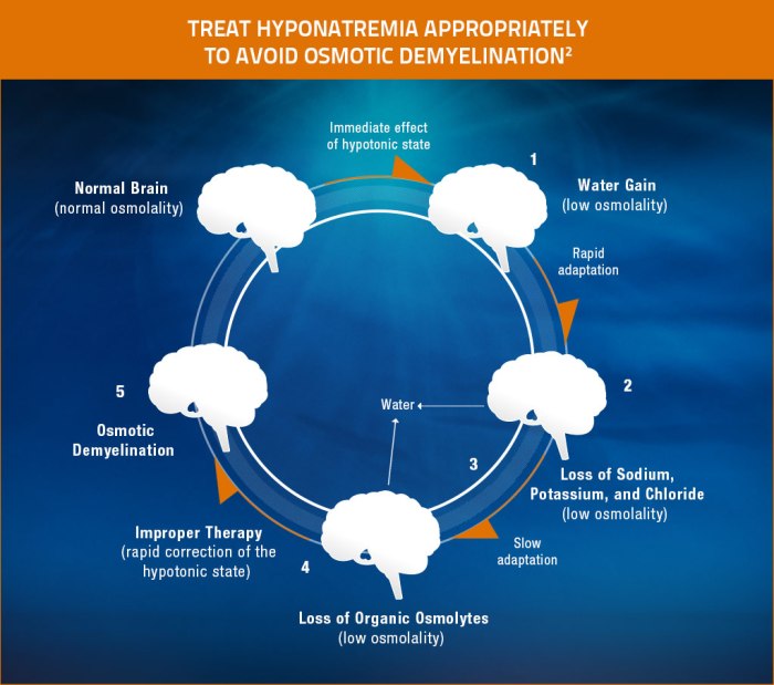 How is brain tissue different from other tissues during hyponatremia